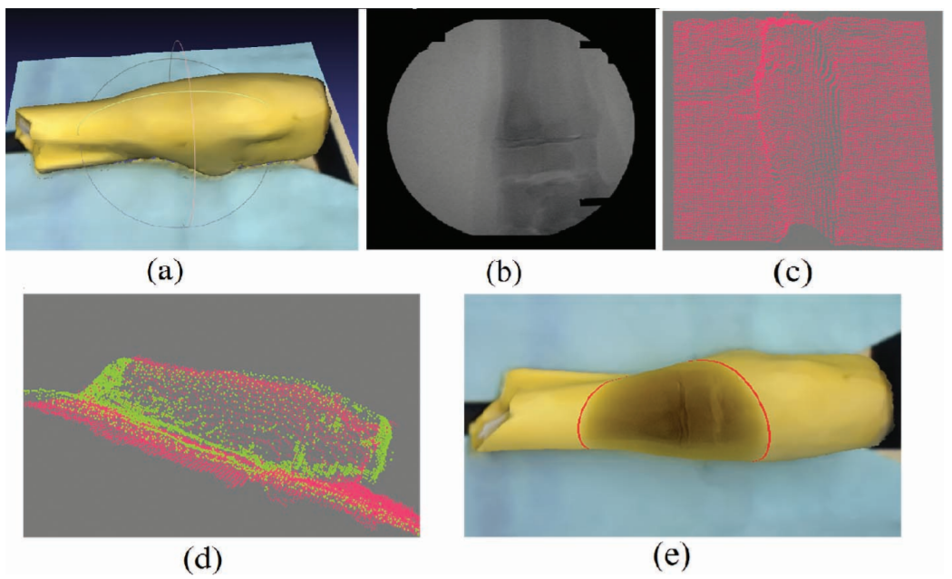 Precise 3D/2D Calibration RGB-D / C-arm
